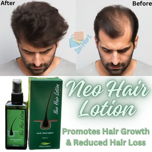 Neo Hair Lotion In Pakistan